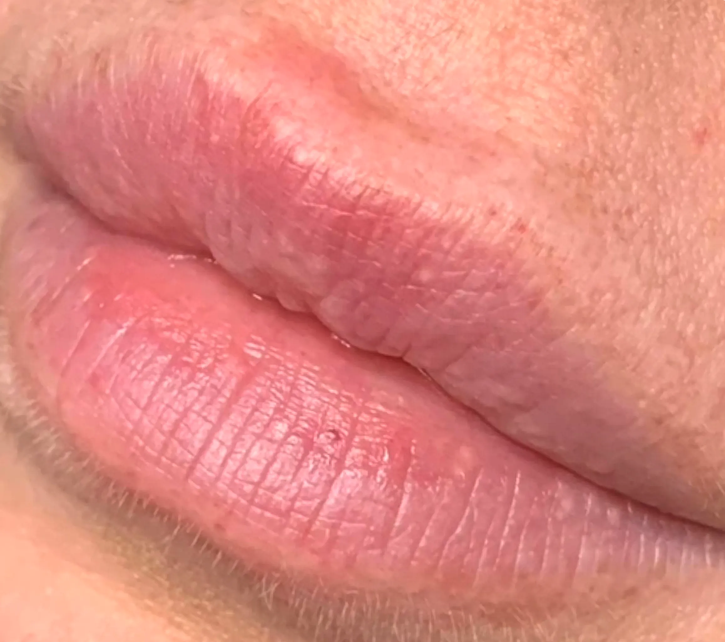 cosmetic tattoo pain comparison