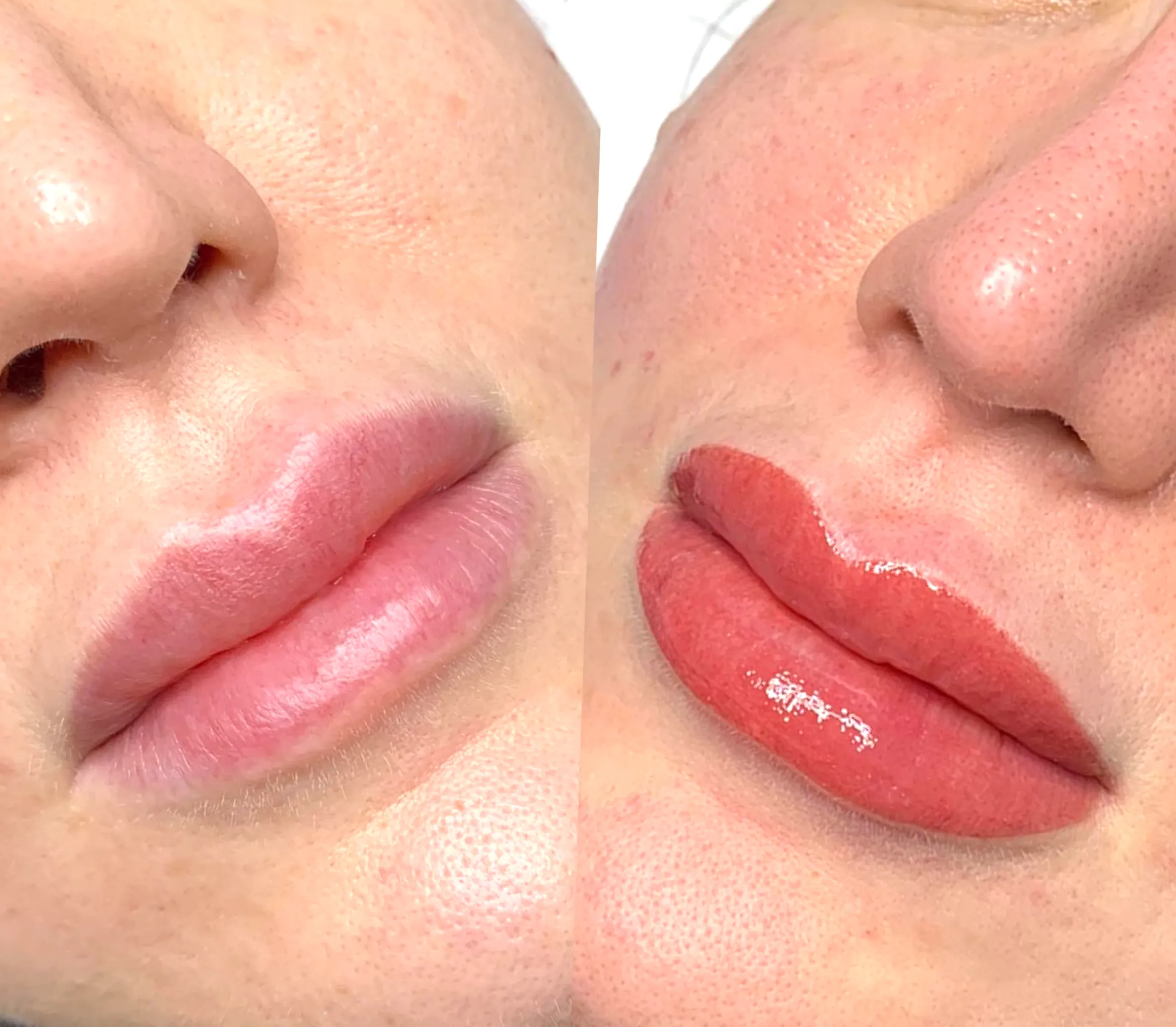 lip blush discomfort