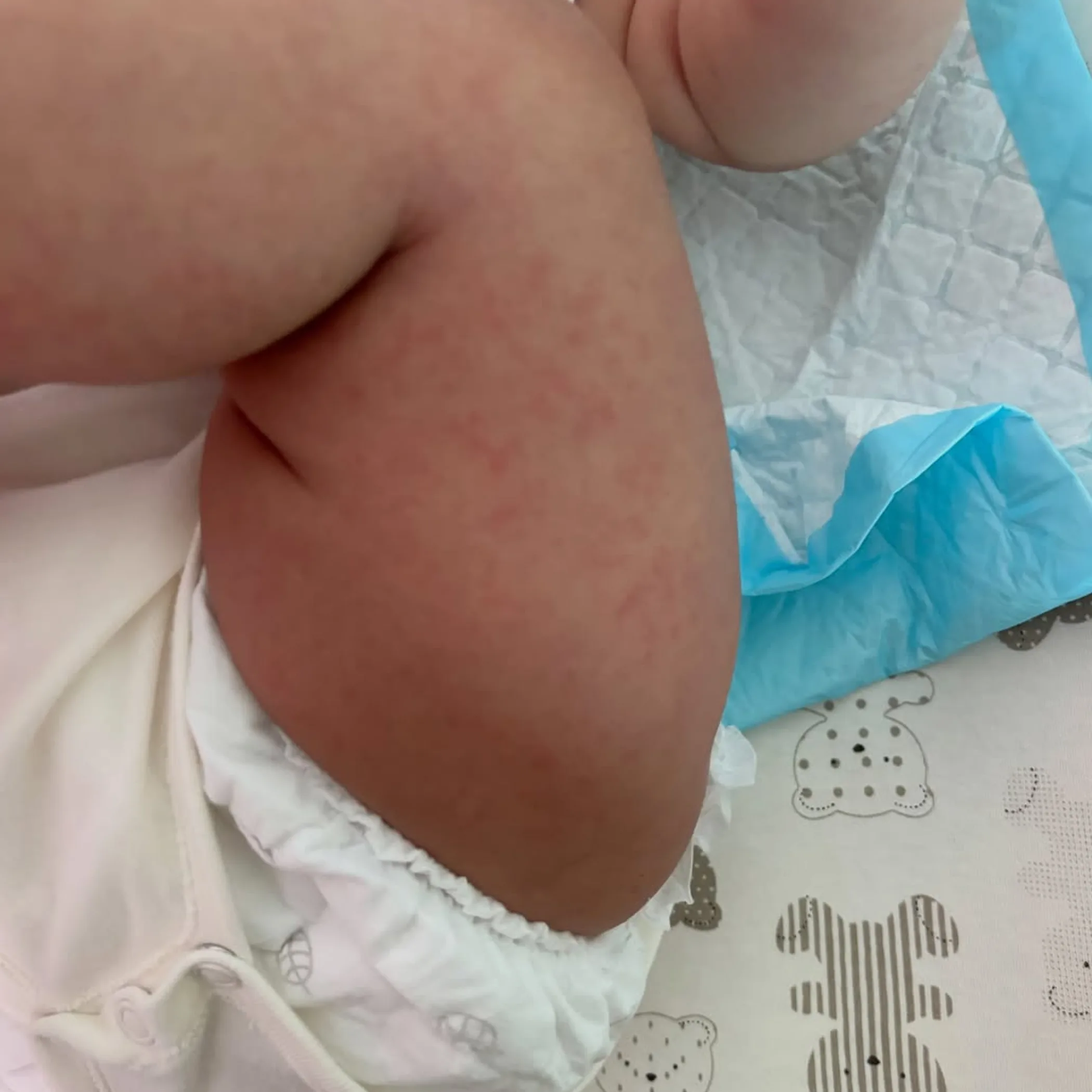 close up red bumps heat rash chest
